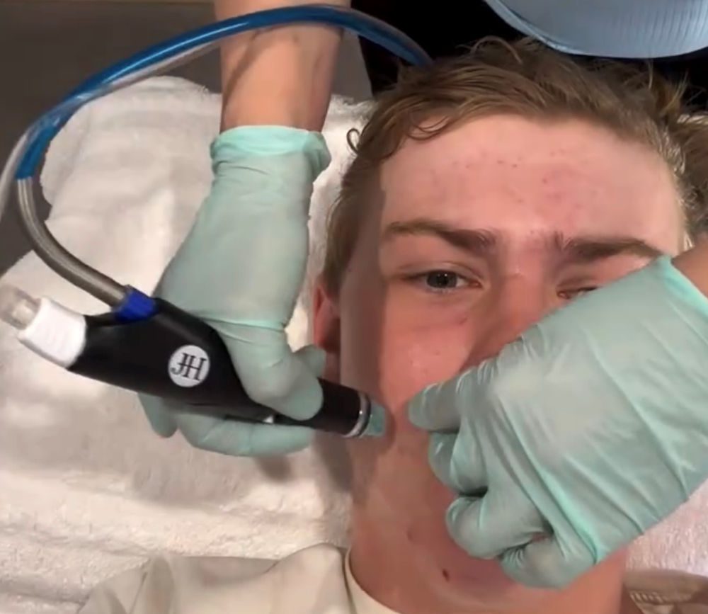 Cleansing facial for teenage skin