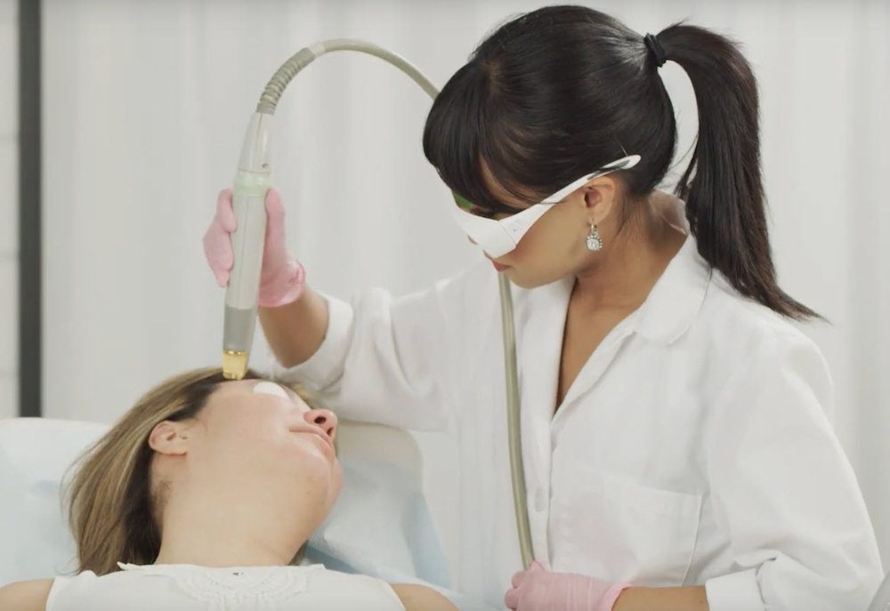 Benefits of Laser Treatments