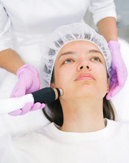 Micro needling ACML
